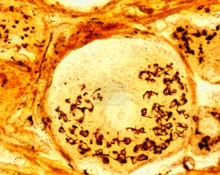 Micrographie à fort grossissement des neurones pseudounipolaires d'un ganglion de la racine dorsale coloré par la méthode formol-uranium silver de Cajal qui démontre l'appareil de Golgi. Il apparaît comme un réseau brun situé dans le corps cellulaire des neurones autour du nu