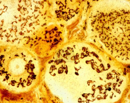High magnification micrograph of pseudounipolar neurons of a dorsal root ganglion stained with the Cajal's formol-uranium silver method that demonstrates the Golgi apparatus. It appears as a brown network located in the neuron cell body around the nu