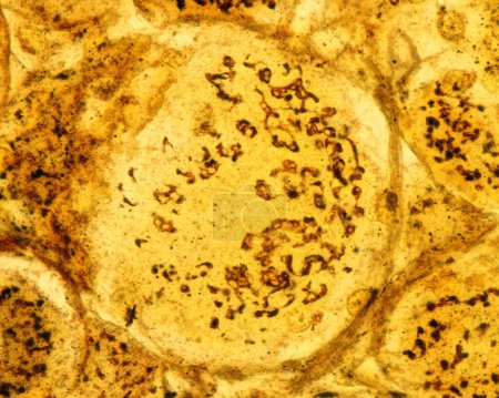 Micrographie à fort grossissement des neurones pseudounipolaires d'un ganglion de la racine dorsale coloré par la méthode formol-uranium silver de Cajal qui démontre l'appareil de Golgi. Il apparaît comme un réseau brun situé dans le corps cellulaire des neurones autour du nu