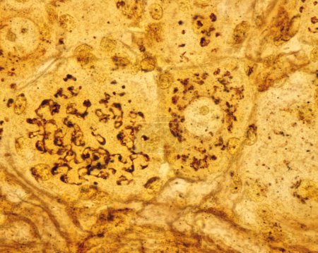Hochvergrößerte Mikrographie pseudounipolarer Neuronen eines dorsalen Wurzelganglions, gefärbt mit der Formol-Uran-Silber-Methode des Cajal, die den Golgi-Apparat demonstriert. Es erscheint als braunes Netzwerk, das sich im Neuronenzellkörper um die nu herum befindet.