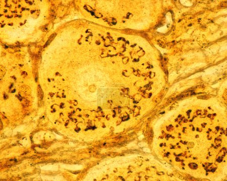 Hochvergrößerte Mikrographie pseudounipolarer Neuronen eines dorsalen Wurzelganglions, gefärbt mit der Formol-Uran-Silber-Methode des Cajal, die den Golgi-Apparat demonstriert. Es erscheint als braunes Netzwerk, das sich im Neuronenzellkörper um die nu herum befindet.