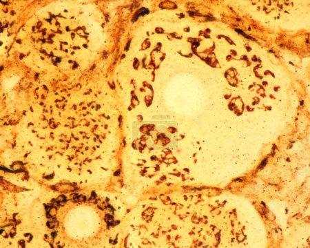 High magnification micrograph of pseudounipolar neurons of a dorsal root ganglion stained with the Cajal's formol-uranium silver method that demonstrates the Golgi apparatus. It appears as a brown network located in the neuron cell body around the nu