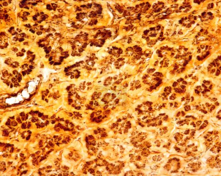 Microscopio de luz que muestra el aparato Golgi en acini pancreático teñido con el método de plata formol-uranio de Cajal. El aparato Golgi aparece como una red de color marrón oscuro situado en el centro de acini.