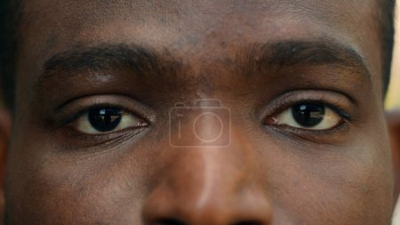 Photo for Close up cropped view detail ad male African American ethnic dark eyes close open blink ophthalmology eyesight see look vision sight eye problem strain ill sick facial expression looking laser surgery - Royalty Free Image