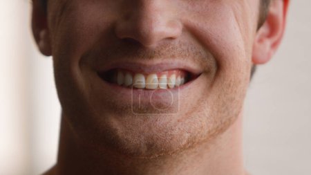 Téléchargez les photos : Vue recadrée méconnaissable homme caucasien sourire dents de sexe masculin dents souriantes heureux joyeux insouciant gai gars à la maison clinique médicale orthodontique dentisterie dentaire hygiène santé dentaire procédure de blanchiment - en image libre de droit