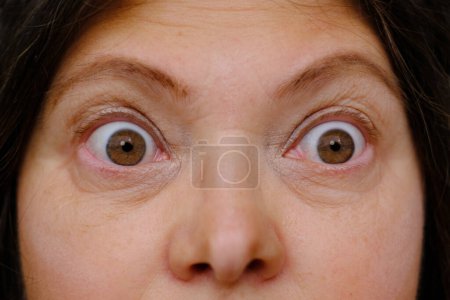 Photo for Middle-aged mature woman with bulging eyes, upper face close-up, goggle eyes in fright, staring at camera, Very strong surprise or fright, horror in look, concept of cosmetic anti-aging procedures - Royalty Free Image