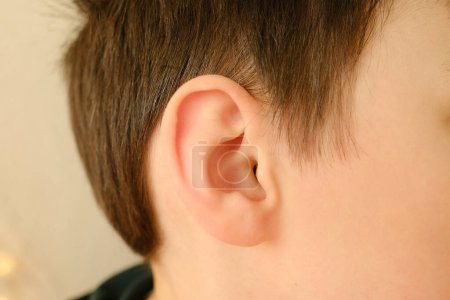 Foto de Oído de un paciente pequeño, niño de 8-10 años, parte de la cara en el primer plano del perfil, concepto médico, control de la audición, inflamación del oído medio, otitis media, diagnóstico y tratamiento de oftalmología, enfermedades del oído - Imagen libre de derechos