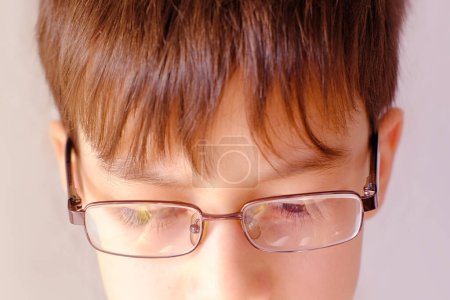 Foto de Closeup child's face, eyes of boy 10-12 years old in glasses, concept of vision examination, eyestrain, diagnosis, treatment of ophthalmic diseases, eyelids, emotional development of children - Imagen libre de derechos