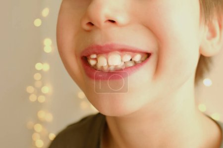 Foto de Primer plano dientes torcidos, niño 9-10 años boca abierta, niño 8 años muestra dientes, visita al dentista para el examen de la cavidad oral, control de molares, dientes temporales, concepto de prevención de la caries - Imagen libre de derechos