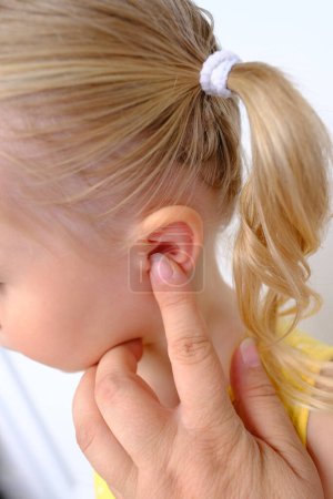 Foto de Oído pequeño paciente, niño, niña de 3 años, parte de la cara en el perfil de primer plano, concepto médico, control de la audición, inflamación del oído medio, otitis media, diagnóstico y tratamiento de oftalmología, enfermedades del oído - Imagen libre de derechos