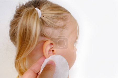 Foto de Oído pequeño paciente, niño, niña 3 años de edad, parte de perfil facial de cerca, perforar el concepto de oídos, control de la audición, inflamación del oído medio, otitis media, diagnóstico y tratamiento de oftálmica, enfermedades del oído - Imagen libre de derechos