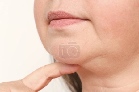 close up part face mature woman 55 years old, human fat neck, side view, double saggy chin, deep wrinkles, age-related skin changes, cosmetic anti-aging procedures, skin tightening