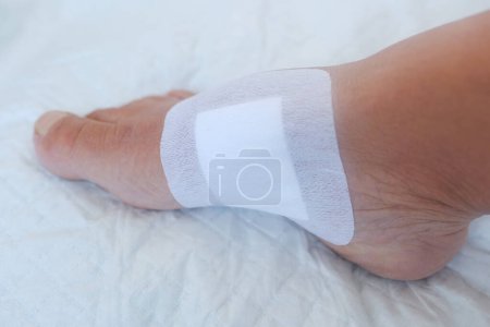 Photo for Closeup white plaster on skin, healing wound, treatment ulcer on female leg, disinfection and wound surface of skin and deep tissues, eliminating inflammatory process, sanitation pathogenic microflora - Royalty Free Image