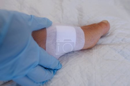 Photo for Closeup of white plaster on skin, doctor in gloves treats wound, healing wound, treatment ulcer on female leg, disinfection and wound surface of skin and deep tissues, sanitation pathogenic microflora - Royalty Free Image