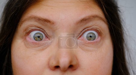 Photo for Middle-aged mature woman with bulging eyes, upper face close-up, goggle eyes in fright, staring at camera, Very strong surprise or fright, horror in look, concept of cosmetic anti-aging procedures - Royalty Free Image