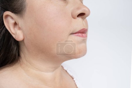 face rapprochée, adulte femme d'âge moyen 45 ans regardant les rides liées à l'âge sur le cou et le menton, problèmes de vieillissement, concept Mal de gorge, âge féminin, inflammation de la thyroïde, aperçu de la glande thyroïde