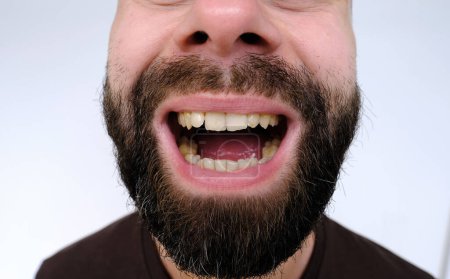 Photo for Close-up cheerful male face of charismatic young bearded satisfied guy 30 years old with playful facial expression fervently laughs, fooling around, close up part funny male face, mental human health - Royalty Free Image