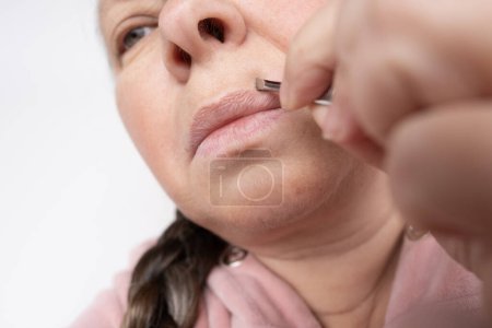 erwachsene Frau zieht aus, entfernt mit Metallpinzette überschüssige Haare im Gesicht in der Nähe der Lippen, Nahaufnahme der Gesichtsbehaarung, Körperpflege und Hygiene