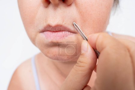 erwachsene Frau zieht aus, entfernt mit Metallpinzette überschüssige Haare im Gesicht in der Nähe der Lippen, Nahaufnahme der Gesichtsbehaarung, Körperpflege und Hygiene