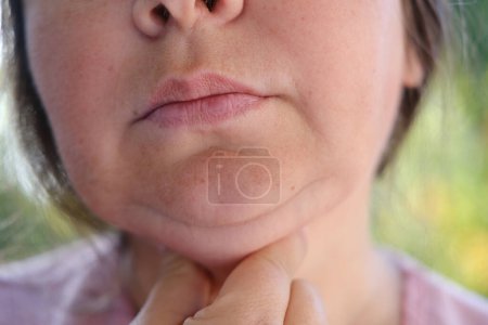 cerrar parte cara mujer madura 55 años, mitad inferior de la cara, arrugas profundas alrededor de la boca, flacidez de las mejillas, flacidez de las mejillas, cosmetología inyección estética, cirugía de corrección, procedimientos antienvejecimiento