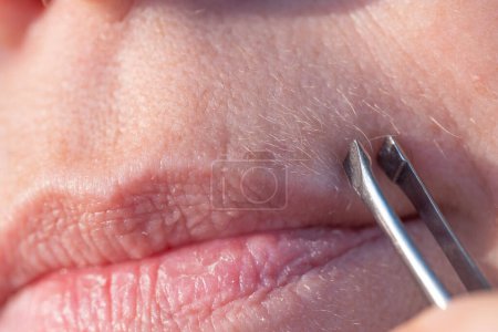 close-up mature female lips, removes with metal tweezers excess facial hair, excessive hair growth, problem of depilation on face, hormonal disorder during menopause