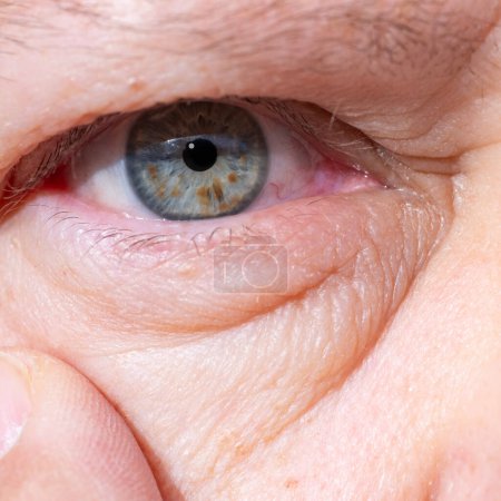 Nahaufnahme des Auges einer reifen Frau, die natürliche Alterserscheinungen wie Falten und Schwellungen unter dem unteren Augenlid zeigt und dennoch Stärke, Allergien, Nierenerkrankungen vermittelt