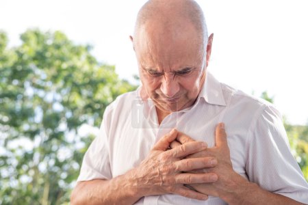 signos de infarto de miocardio, anciano, hombre maduro caucásico 65 años sostiene el corazón, dolor torácico repentino, hipertensión arterial, miocarditis o arritmia, primeros auxilios