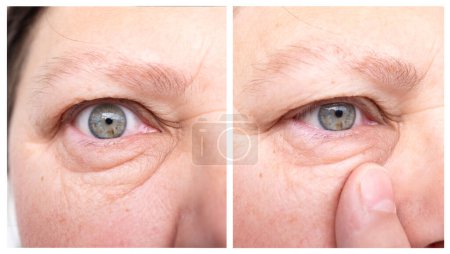 Nahaufnahme Gesicht Frau mittleren Alters in zwei Versionen, Auge, offenbart natürliche Zeichen des Alterns wie Falten und Schwellungen unter dem unteren Augenlid, aber immer noch vermittelt Stärke, Widerstandsfähigkeit