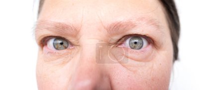 close-up mature woman's eye, under eye bags, wrinkles and puffiness under lower eyelid, yet still conveying strength, resilience, and wisdom, female aging