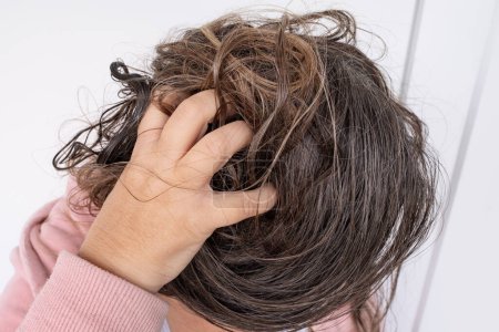 woman scratching brown hair, feeling itchy and possibly having lice, showing effects of infestation, Medical conditions, Pediculosis, itching and irritation