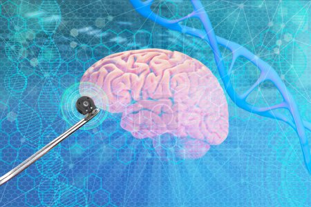 Electronic chip, bug in scientist's hand, Successful implantation of wireless chip into human brain, Cybernetics and Human Enhancement, Future of Brain-Computer Interfaces