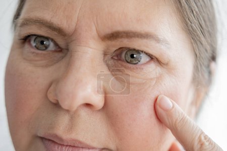 primer plano parte de la cara femenina madura, mujer 50-55 años de edad mira cuidadosamente examina las arrugas alrededor de los ojos, pliegues de la piel, cambios relacionados con la edad, cosmetología inyección estética, procedimientos anti-envejecimiento de cuidado