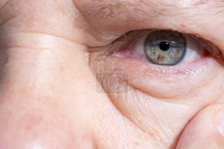 Nahaufnahme eines reifen weiblichen Auges, das natürliche Alterserscheinungen wie Falten und Schwellungen unter dem unteren Augenlid, Allergien, Nierenerkrankungen offenbart und dennoch Stärke, Widerstandskraft und Weisheit vermittelt
