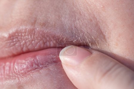 Close-up reifen weiblichen Lippen, entfernt überschüssige Gesichtsbehaarung, übermäßiges Haarwachstum, Problem der Enthaarung im Gesicht, hormonelle Störung in den Wechseljahren