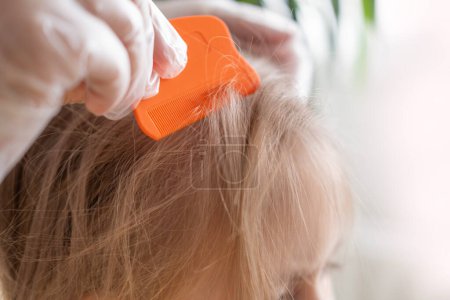 Primer plano de la cabeza del niño con las manos femeninas en busca de piojos y liendres en el cabello, peinando con peine naranja para su eliminación, examen médico