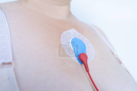 Sensoren auf der Brust für Holter-Überwachung, Frau mit Holter-Monitor tägliche Überwachung von Elektrokardiogramm, Blutdruck, Herzuntersuchung, Behandlung von Herzkrankheiten, Track-Schrittmacher-Dysfunktion
