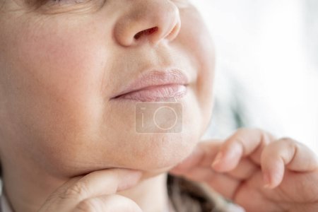Doppelkinn-Gesicht reife Frau 50 Jahre alt, menschlicher Fetthals, Seitenansicht, Falten auf der Haut, Facelift, altersbedingte Hautveränderungen, ästhetische Injektionskosmetologie, Pflege Anti-Aging-Verfahren