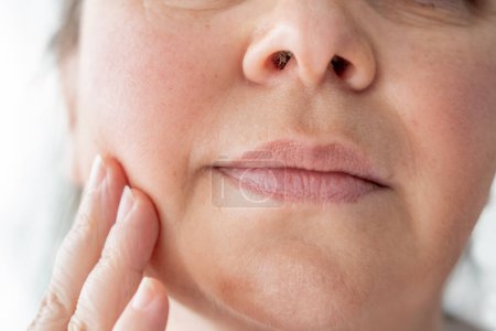 Doppelkinn Gesicht reife Frau 50 Jahre alt, menschlicher Fetthals, Falten auf der Haut, Facelift, altersbedingte Hautveränderungen, ästhetische Injektionskosmetologie, Pflege Anti-Aging-Verfahren