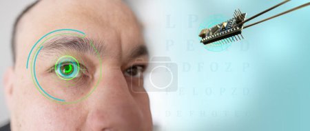 Einbau elektronischer Chips in menschliche bionische, neuroprothetische Augen, modernste Technologie, visionärer technologischer Fortschritt und futuristische Vision