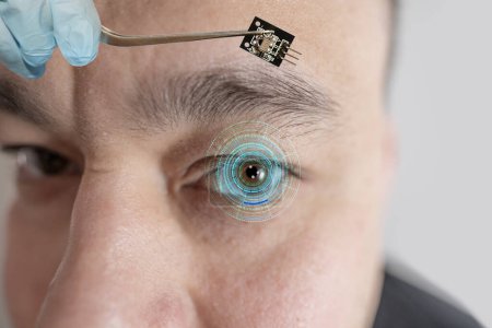 Instalación de chip electrónico en biónico humano, ojo neuroprotésico, tecnología de vanguardia, avance tecnológico visionario, restaurar la vista