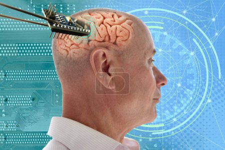 Photo for Installing electronic chip into human brain, applied in various fields neurotechnology and medical science, cutting-edge technology, restore sight - Royalty Free Image