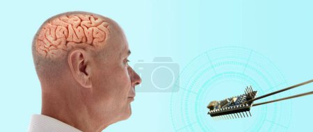 Photo for Installing electronic chip into human brain, applied in various fields neurotechnology and medical science, computer control person - Royalty Free Image