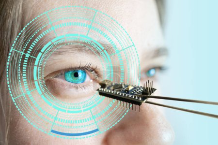 Instalación de chip electrónico en biónico humano, ojo neuroprotésico, tecnología de vanguardia, avance tecnológico visionario, restaurar la vista