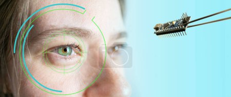 Installation elektronischer Chips in menschliche bionische, neuroprothetische Augen, modernste Technologie, futuristisches Sehen, Wiederherstellung des Sehvermögens