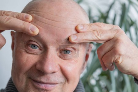 Hombre de 65 años de edad, senior examina cuidadosamente las arrugas en la cara, pliegues de la piel, cambios en la piel relacionados con la edad, cosmetología inyección estética, procedimientos anti-envejecimiento del cuidado