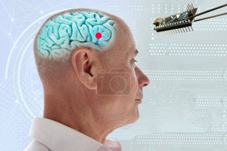 Installation elektronischer Chips im menschlichen Gehirn, angewandt in verschiedenen Bereichen der Neurotechnologie und Medizin, Computer-Kontrolleur