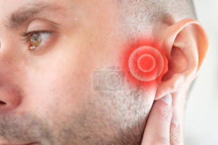 kaukasischer junger Mann starke Ohrenschmerzen, Festhalten an betroffenem Bereich, Linderung von Schmerzen und Lärm, vermindertes Gehör, Klingeln in den Ohren, Taubheit, Schallempfindlichkeit