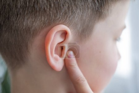 Detailaufnahme Kinderohr, starke Ohrenschmerzen, Festhalten an der betroffenen Stelle, Hörverlust, Klingeln in den Ohren, Taubheit, Schallempfindlichkeit