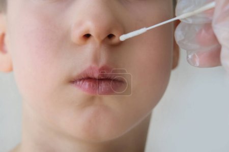 doctor takes cotton bud from childs nose to analyze the saliva, mucous membrane for DNA tests, COVID-19, boy of 10 years old endures procedure patiently, epidemic concept, coronavirus 
