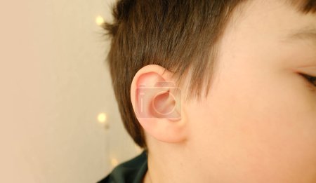 Foto de Oído de un paciente pequeño, niño de 8-10 años, parte de la cara en el primer plano del perfil, concepto médico, control de la audición, inflamación del oído medio, otitis media, diagnóstico y tratamiento de oftalmología, enfermedades del oído - Imagen libre de derechos